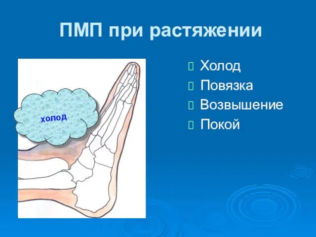 ПМП при растяжении Холод Повязка Возвышение Покой