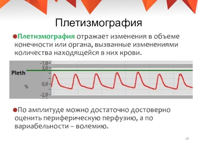 Плетизмография