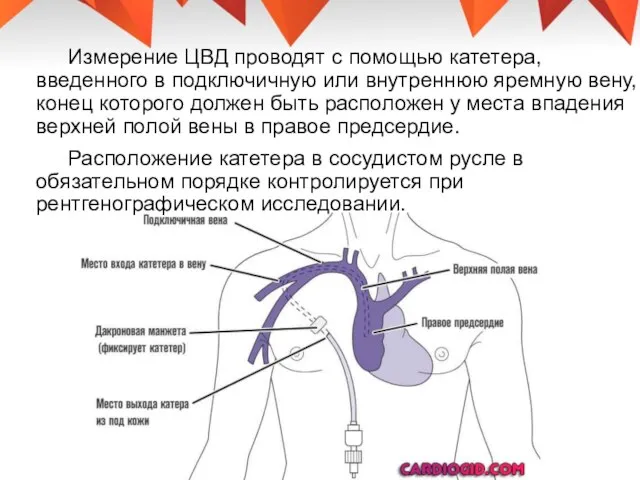 Измерение ЦВД проводят с помощью катетера, введенного в подключичную или внутреннюю яремную