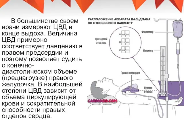 В большинстве своем врачи измеряют ЦВД в конце выдоха. Величина ЦВД примерно