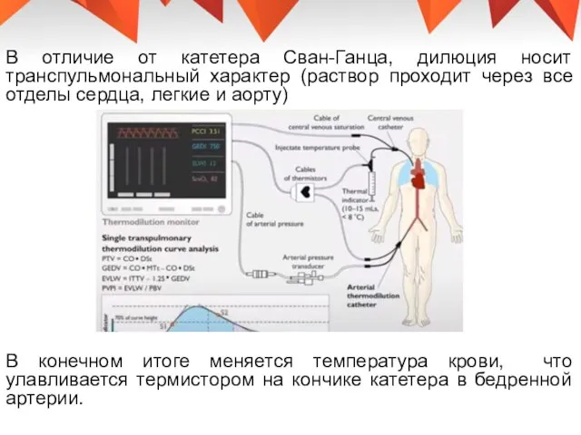 В отличие от катетера Сван-Ганца, дилюция носит транспульмональный характер (раствор проходит через