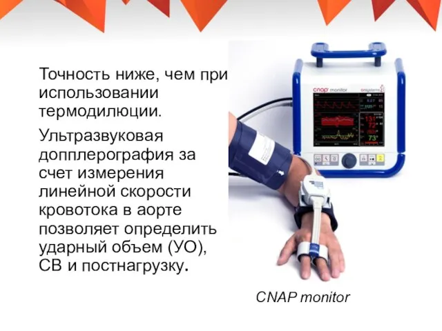 Точность ниже, чем при использовании термодилюции. Ультразвуковая допплерография за счет измерения линейной