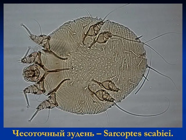 Чесоточный зудень – Sarcoptes scabiei.