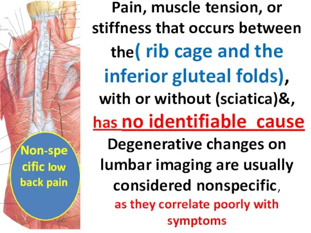 Non-specific low back pain Pain, muscle tension, or stiffness that occurs between