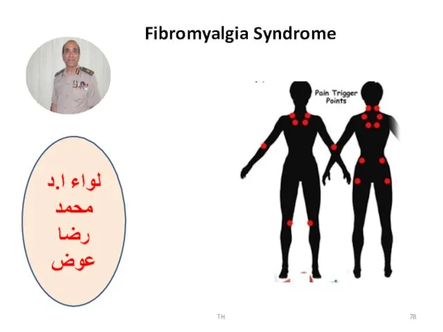 TH لواء ا.د محمد رضا عوض Fibromyalgia Syndrome