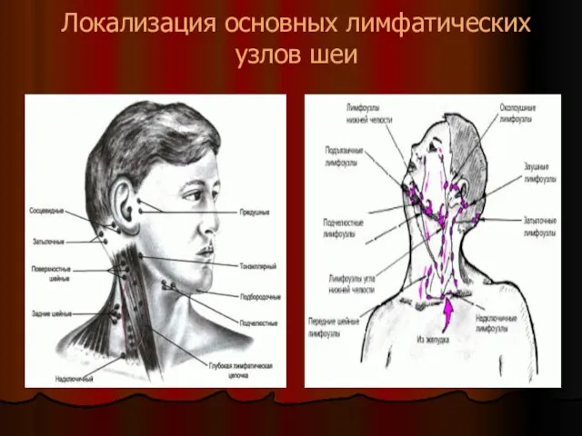 Локализация основных лимфатических узлов шеи