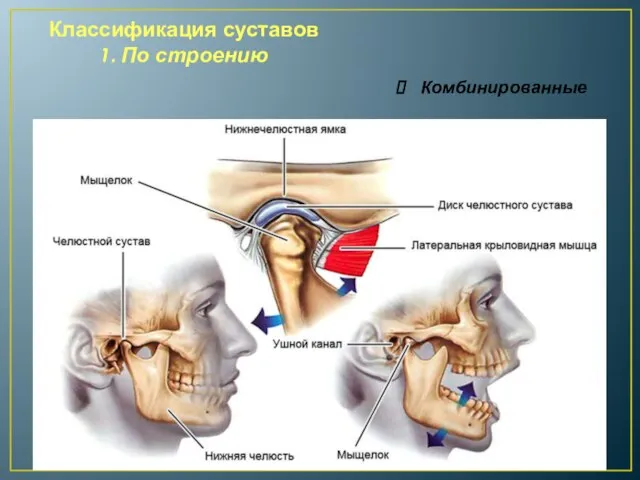 Классификация суставов 1. По строению Комбинированные