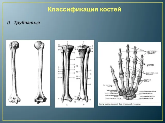 Классификация костей Трубчатые