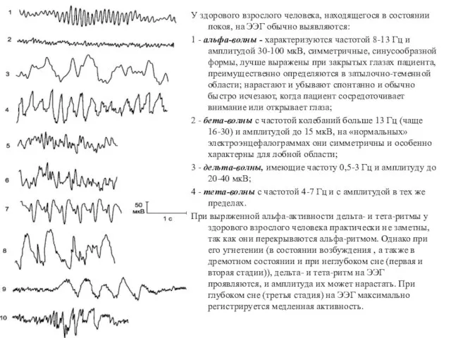 У здорового взрослого человека, находящегося в состоянии покоя, на ЭЭГ обычно выявляются: