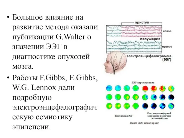 Большое влияние на развитие метода оказали публикации G.Walter о значении ЭЭГ в