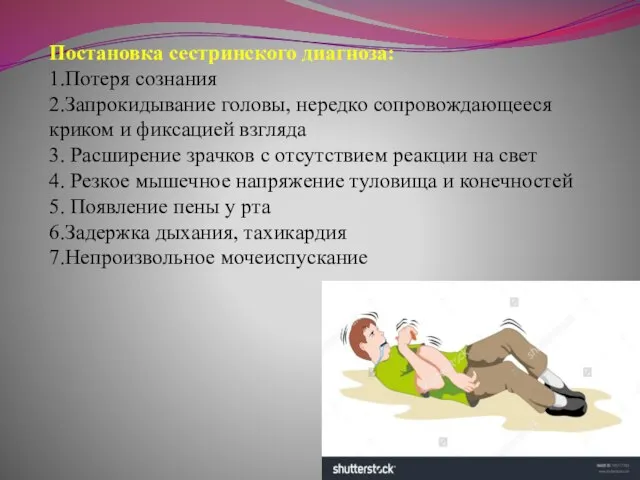 Постановка сестринского диагноза: 1.Потеря сознания 2.Запрокидывание головы, нередко сопровождающееся криком и фиксацией