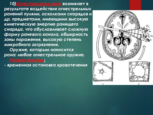 10)Огнестрельная рана возникает в результате воздействия огнестрельных ранений пулями, осколками снарядов и