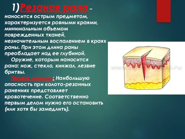 1)Резаная рана – наносится острым предметом, характеризуется ровными краями, минимальным объемом поврежденных