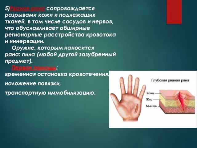 5)Рваная рана сопровождается разрывами кожи и подлежащих тканей, в том числе сосудов