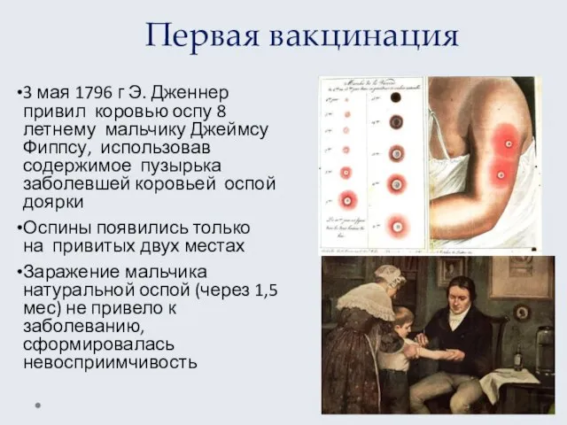 Первая вакцинация 3 мая 1796 г Э. Дженнер привил коровью оспу 8­летнему