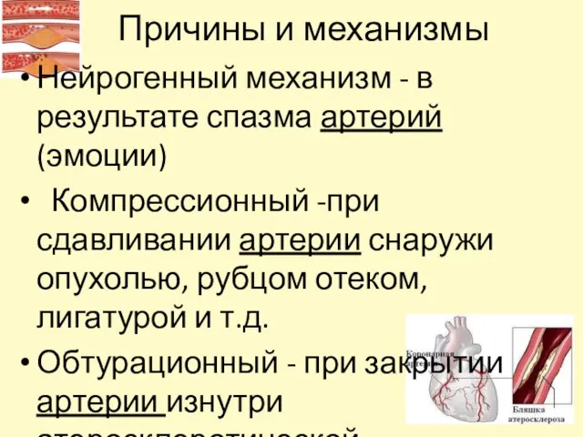 Причины и механизмы Нейрогенный механизм - в результате спазма артерий (эмоции) Компрессионный