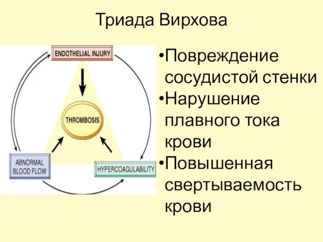 Триада Вирхова Повреждение сосудистой стенки Нарушение плавного тока крови Повышенная свертываемость крови