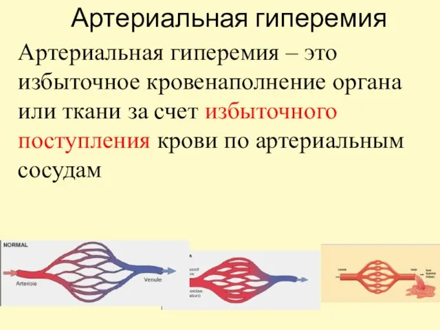 Артериальная гиперемия Артериальная гиперемия – это избыточное кровенаполнение органа или ткани за