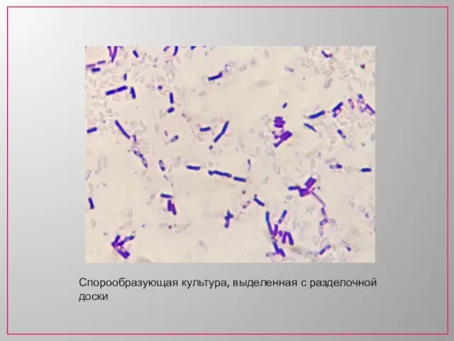 Спорообразующая культура, выделенная с разделочной доски
