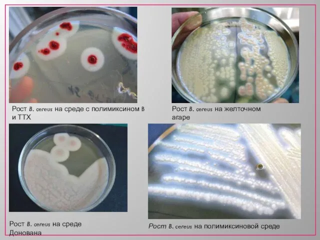 Рост B. cereus на среде с полимиксином B и ТТХ Рост B.