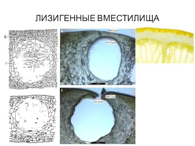 ЛИЗИГЕННЫЕ ВМЕСТИЛИЩА