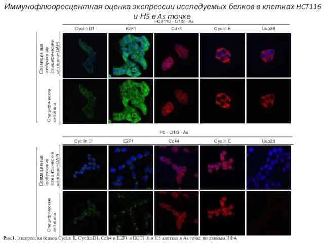 Cyclin D1 E2F1 Cdk4 Cпецифические антитела Совмещенные изображения (специфические антитела+DAPI Cyclin D1