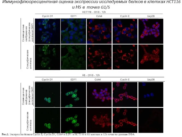 HCT116 - G1/S - 12h Cyclin D1 E2F1 Cdk4 Cyclin E Cпецифические