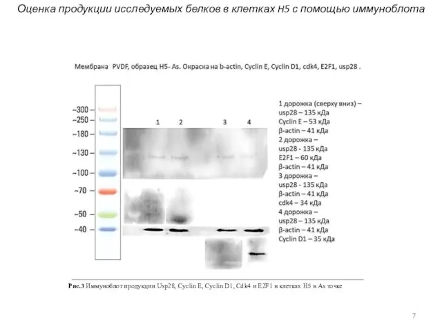 Рис.3 Иммуноблот продукции Usp28, Cyclin E, Cyclin D1, Cdk4 и E2F1 в