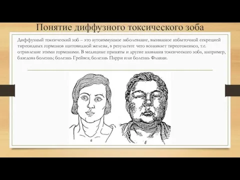 Понятие диффузного токсического зоба Диффузный токсический зоб – это аутоиммунное заболевание, вызванное