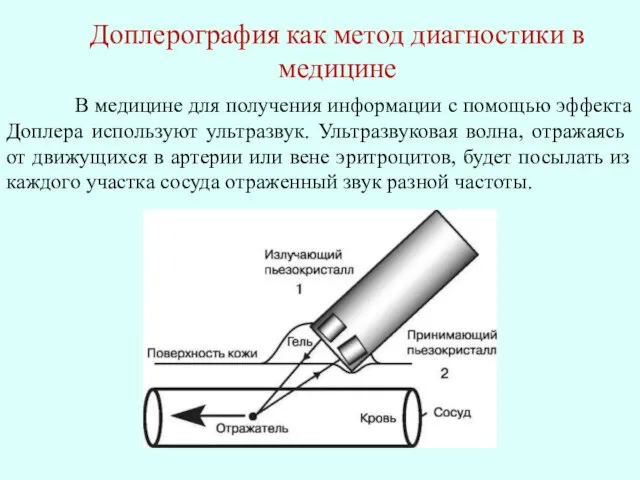 В медицине для получения информации с помощью эффекта Доплера используют ультразвук. Ультразвуковая