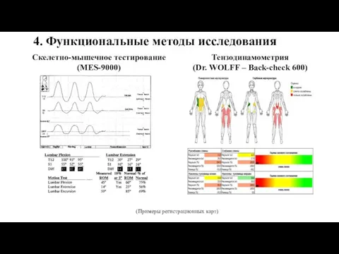 4. Функциональные методы исследования Скелетно-мышечное тестирование (MES-9000) Тензодинамометрия (Dr. WOLFF – Back-check 600) (Примеры регистрационных карт)