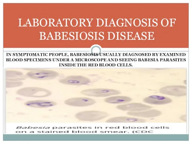 IN SYMPTOMATIC PEOPLE, BABESIOSIS USUALLY DIAGNOSED BY EXAMINED BLOOD SPECIMENS UNDER A