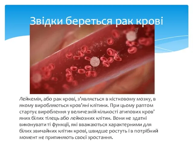 Звідки береться рак крові Лейкемія, або рак крові, з’являється в кістковому мозку,