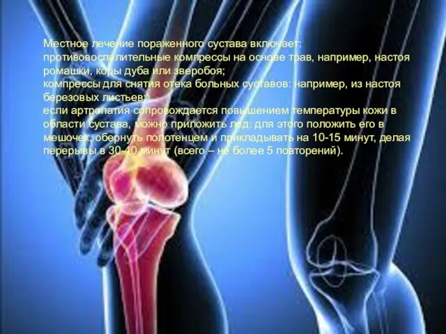Местное лечение пораженного сустава включает: противовоспалительные компрессы на основе трав, например, настоя