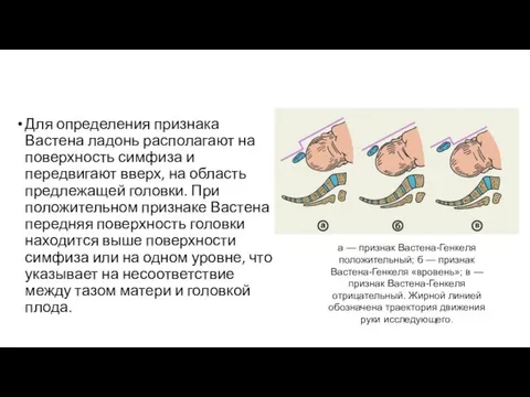 Для определения признака Вастена ладонь располагают на поверхность симфиза и передвигают вверх,