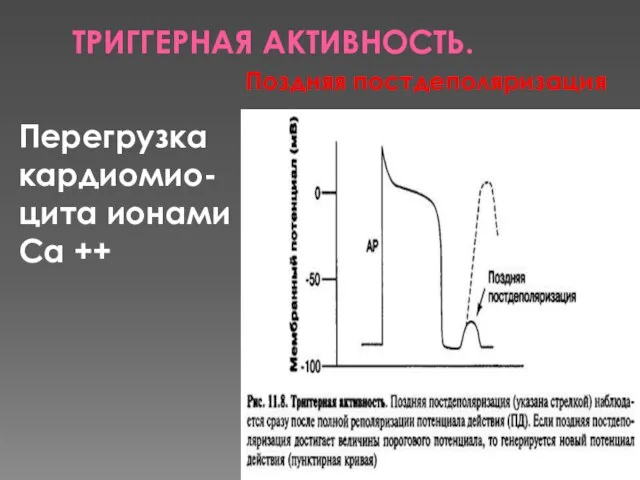 ТРИГГЕРНАЯ АКТИВНОСТЬ. Перегрузка кардиомио-цита ионами Са ++ Поздняя постдеполяризация