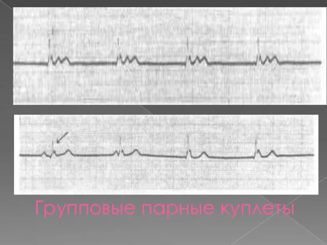 Групповые парные куплеты