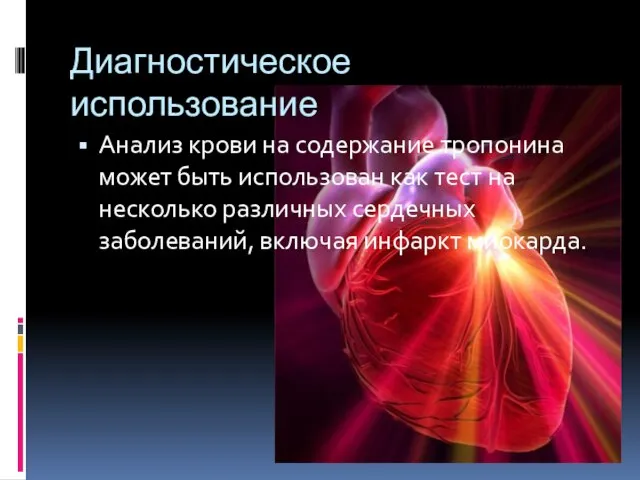 Диагностическое использование Анализ крови на содержание тропонина может быть использован как тест