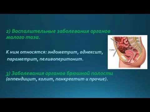 2) Воспалительные заболевания органов малого таза. К ним относятся: эндометрит, аднексит, параметрит,