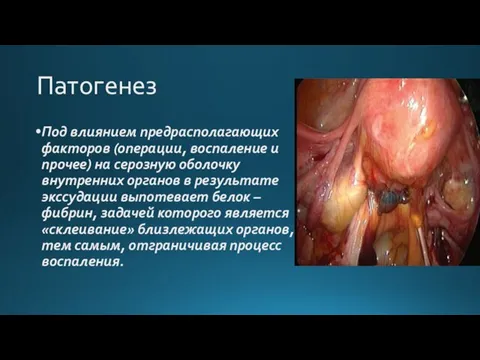 Патогенез Под влиянием предрасполагающих факторов (операции, воспаление и прочее) на серозную оболочку