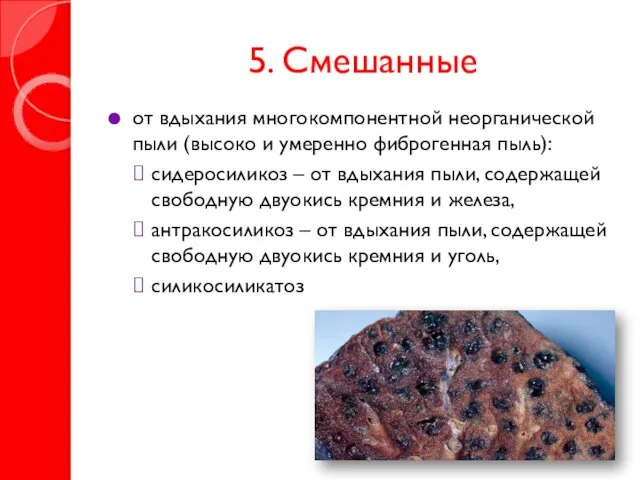 5. Смешанные от вдыхания многокомпонентной неорганической пыли (высоко и умеренно фиброгенная пыль):