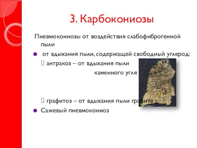 3. Карбокониозы Пневмокониозы от воздействия слабофиброгенной пыли от вдыхания пыли, содержащей свободный