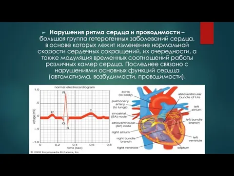 Нарушения ритма сердца и проводимости – большая группа гетерогенных заболеваний сердца, в