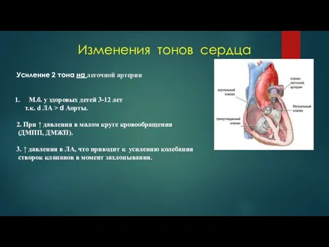 Изменения тонов сердца Усиление 2 тона на легочной артерии М.б. у здоровых