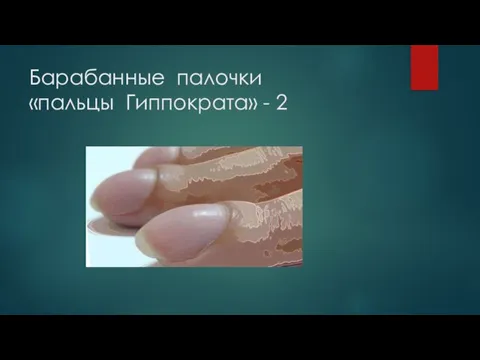 Барабанные палочки «пальцы Гиппократа» - 2