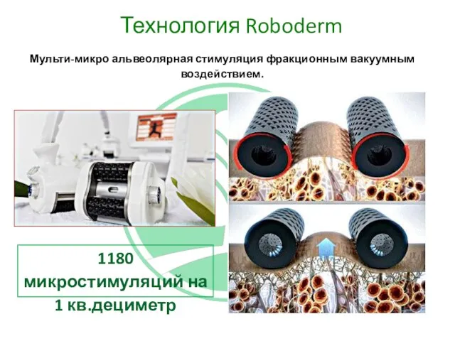 Технология Roboderm Мульти-микро альвеолярная стимуляция фракционным вакуумным воздействием. 1180 микростимуляций на 1 кв.дециметр