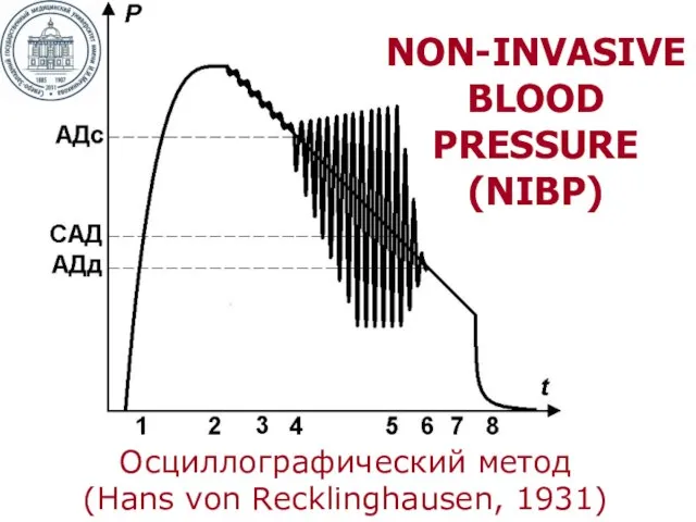 Осциллографический метод (Hans von Recklinghausen, 1931) NON-INVASIVE BLOOD PRESSURE (NIBP)