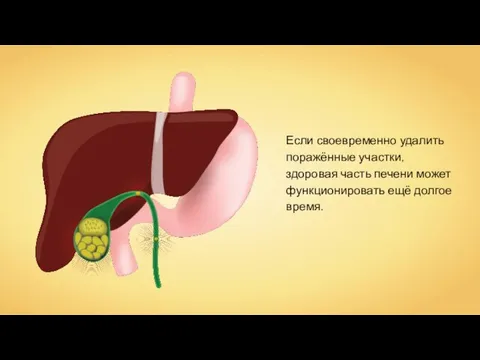 Если своевременно удалить поражённые участки, здоровая часть печени может функционировать ещё долгое время.