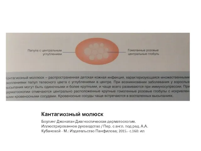 Кантагиозный молюск Боулинг Джонатан Диагностическая дерматоскопия. Иллюстрированное руководство / Пер. с англ.