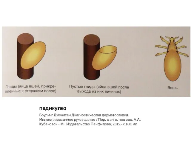 педикулез Боулинг Джонатан Диагностическая дерматоскопия. Иллюстрированное руководство / Пер. с англ. под